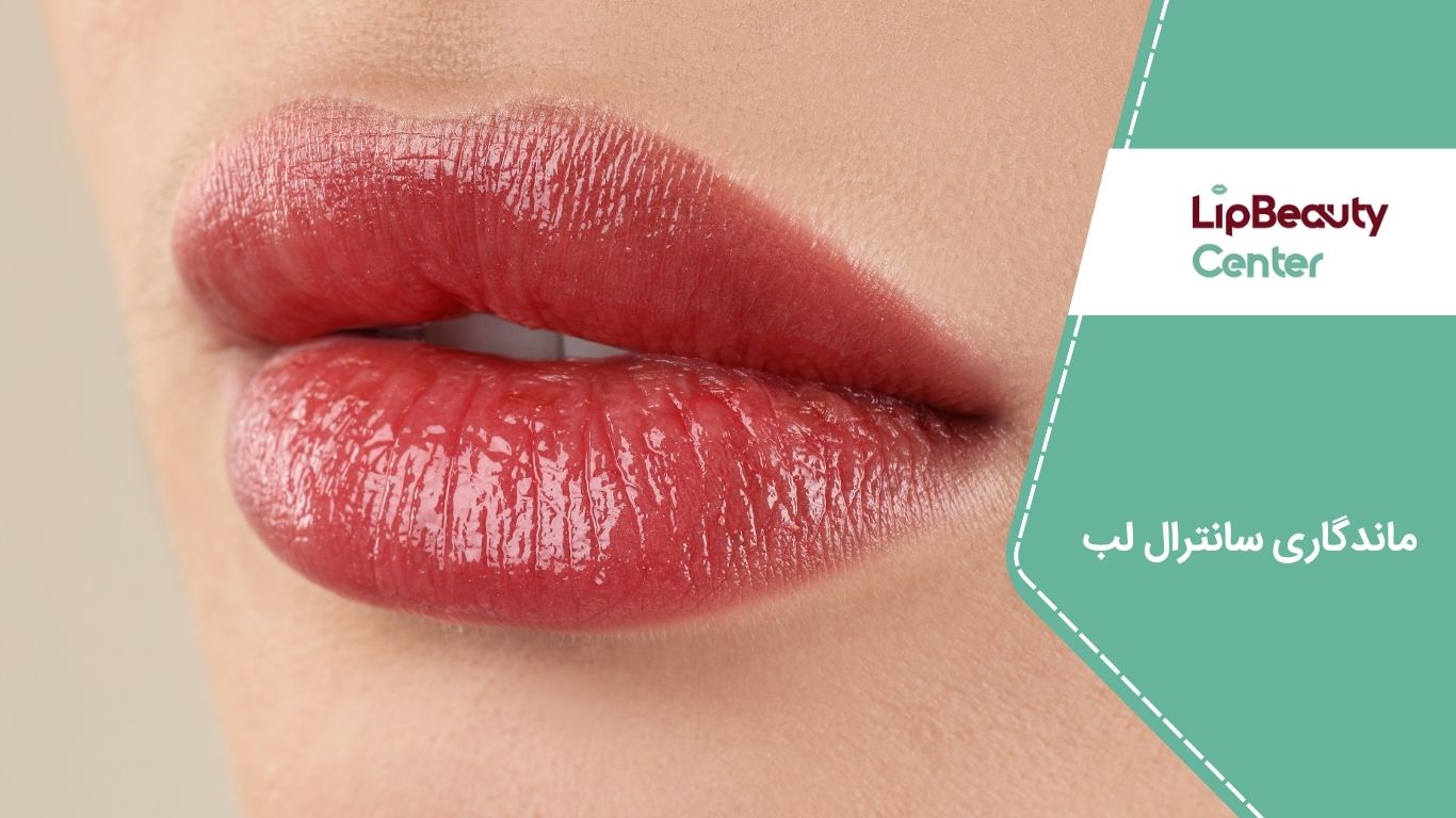 ماندگاری سانترال لب