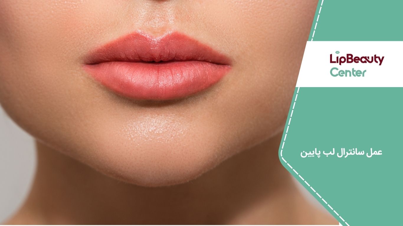 جراحی سانترال لب پایین یک روش زیبایی نسبتاً دائمی است که با هدف اصلاح فرم، حجم و تناسب لب پایین انجام می‌شود.
