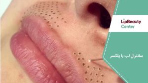 سانترال لب با پلکسر