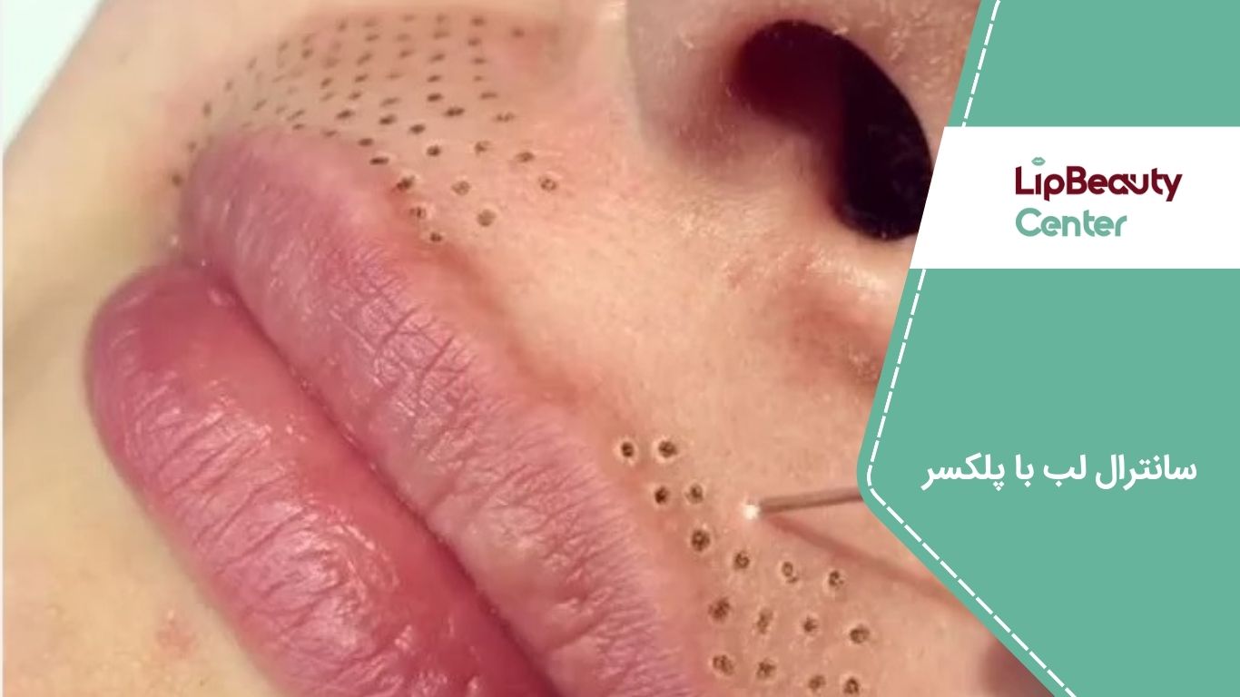 سانترال لب با پلکسر