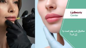 سانترال لب بهتر است یا ژل لب