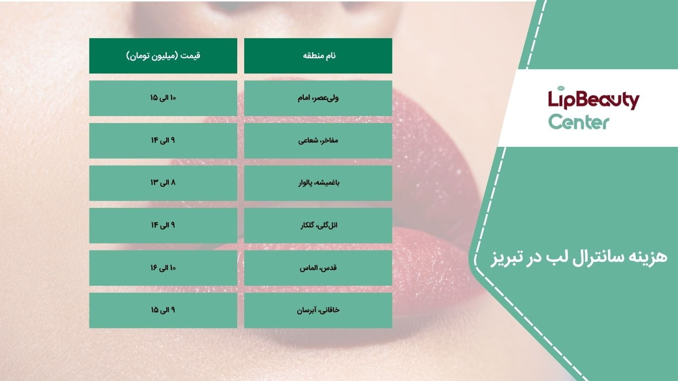 هزینه سانترال لب در تبریز